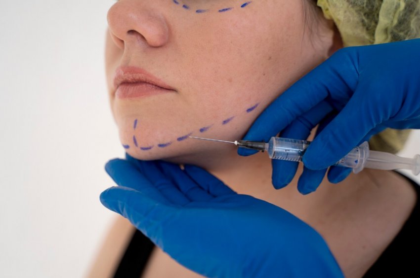 Adana’da Endolift ile Ameliyatsız Yüz ve Boyun Gençleştirme İpuçları