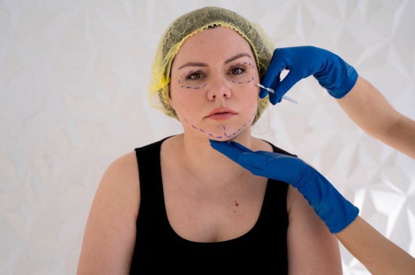 Adana’da Endolift Lazer ile Göz Altı Torbaları ve Çizgilerini Azaltma